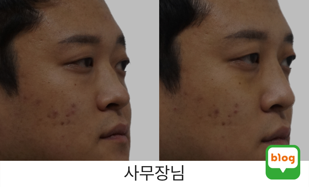 사무장님 2차 레이디코 후기