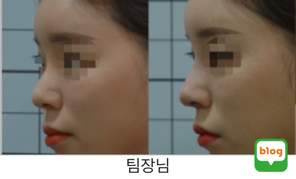 팀장님 레이디코 후기